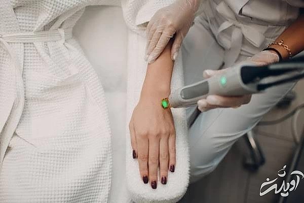 لیزر موهای زائد لبزر کردن موهای زائد